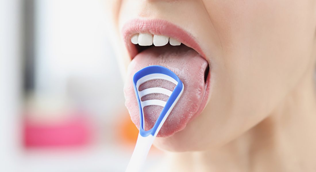 Mavi Dil Hastalığı Nedir Belirtileri Nelerdir? Mavi dil virüsü (Bluetongue