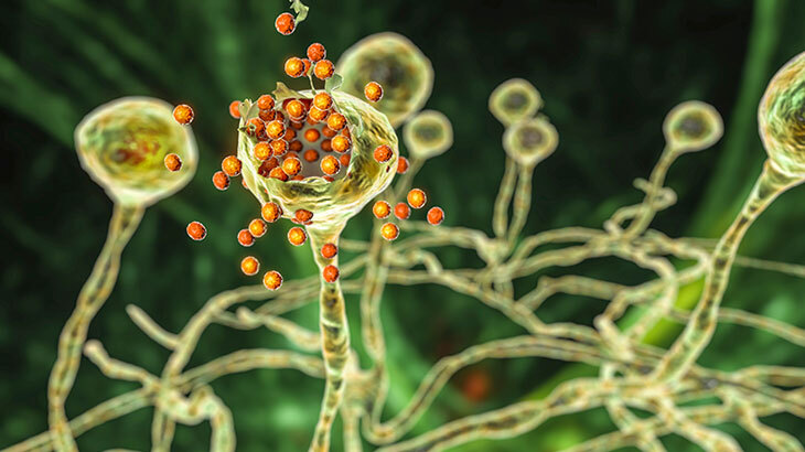 Kara Mantar Hastalığı Nedir Belirtileri Nelerdir? Kara mantar olarak bilinen